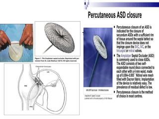 Tran catheter closure of ASD
 