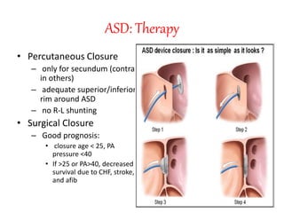 ASD: Therapy
• Percutaneous Closure
– only for secundum (contra
in others)
– adequate superior/inferior
rim around ASD
– no R-L shunting
• Surgical Closure
– Good prognosis:
• closure age < 25, PA
pressure <40
• If >25 or PA>40, decreased
survival due to CHF, stroke,
and afib
 