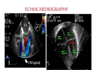 ECHOCARDIOGRAPHY
 