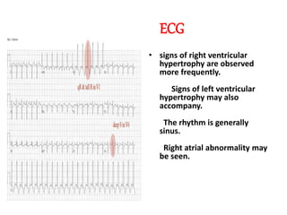 ECG
• signs of right ventricular
hypertrophy are observed
more frequently.
Signs of left ventricular
hypertrophy may also
accompany.
The rhythm is generally
sinus.
Right atrial abnormality may
be seen.
 