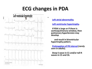 ECG changes in PDA
•
Left atrial abnormality.
Left ventricular hypertrophy.
If PDA is large or if there is
aorticopulmonary window, then
pulmonary hypertension may
develop
and result in biventricular
hypertrophy pattern.
Prolongation of PR interval (rarely
seen in adults).
Deep S wave in C1 and/or tall R
waves in C5 and C6.
 
