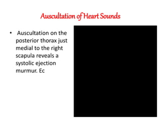 Auscultation of Heart Sounds
• Auscultation on the
posterior thorax just
medial to the right
scapula reveals a
systolic ejection
murmur. Ec
 