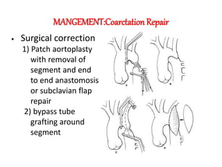 MANGEMENT:Coarctation Repair
• Surgical correction
1) Patch aortoplasty
with removal of
segment and end
to end anastomosis
or subclavian flap
repair
2) bypass tube
grafting around
segment
 