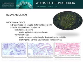 WORKSHOP ESTOMATOLOGIA
SALA ARRÁBIDA – 10:00 às 12:30
BGSM: AMOSTRAS
MICROSCOPIA OPTICA
≥ 1 GSM fixada em solução de formaldeído a 10%
inclusão em parafina e corada com
hematoxilina e eosina
avaliar a glândula na generalidade
Vermelho Congo
avaliar presença e distribuição de depósitos de amilóide
birefringencia verde à luz polarizada (característica)
 