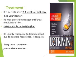 Treatment
 If it persists after 2-4 weeks of self-care:
 See your Doctor.
 He may prescribe stronger antifungal
medications like:
 ketoconazole or terbinafine.
 Its usually responsive to treatment but
due to possible recurrence, it requires:
 long term treatment
 preventive measures.
13
 