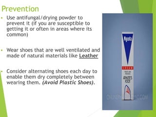 Prevention
 Use antifungal/drying powder to
prevent it (if you are susceptible to
getting it or often in areas where its
common)
 Wear shoes that are well ventilated and
made of natural materials like Leather
 Consider alternating shoes each day to
enable them dry completely between
wearing them. (Avoid Plastic Shoes).
16
 