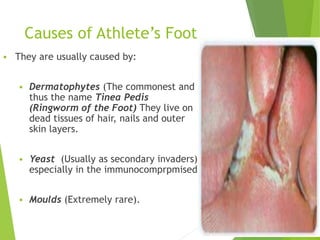 Causes of Athlete’s Foot
 They are usually caused by:
 Dermatophytes (The commonest and
thus the name Tinea Pedis
(Ringworm of the Foot) They live on
dead tissues of hair, nails and outer
skin layers.
 Yeast (Usually as secondary invaders)
especially in the immunocomprpmised
 Moulds (Extremely rare).
4
 