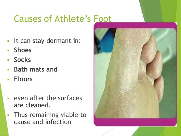 athletes foot slides