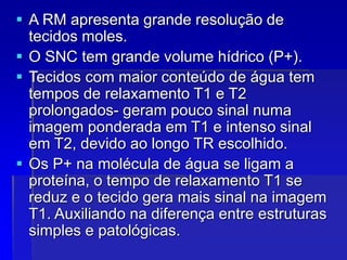  A RM apresenta grande resolução de
tecidos moles.
 O SNC tem grande volume hídrico (P+).
 Tecidos com maior conteúdo de água tem
tempos de relaxamento T1 e T2
prolongados- geram pouco sinal numa
imagem ponderada em T1 e intenso sinal
em T2, devido ao longo TR escolhido.
 Os P+ na molécula de água se ligam a
proteína, o tempo de relaxamento T1 se
reduz e o tecido gera mais sinal na imagem
T1. Auxiliando na diferença entre estruturas
simples e patológicas.
 