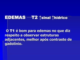 EDEMAS T2 ↑sinal ↑hídrico
O T1 é bom para edemas no que diz
respeito a observar estruturas
adjacentes, melhor após contraste de
gadolínio.
 