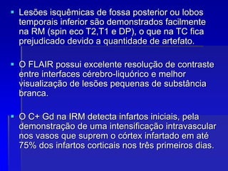  Lesões isquêmicas de fossa posterior ou lobos
temporais inferior são demonstrados facilmente
na RM (spin eco T2,T1 e DP), o que na TC fica
prejudicado devido a quantidade de artefato.
 O FLAIR possui excelente resolução de contraste
entre interfaces cérebro-liquórico e melhor
visualização de lesões pequenas de substância
branca.
 O C+ Gd na IRM detecta infartos iniciais, pela
demonstração de uma intensificação intravascular
nos vasos que suprem o córtex infartado em até
75% dos infartos corticais nos três primeiros dias.
 
