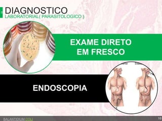 DIAGNOSTICO
BALANTIDIUM COLI
EXAME DIRETO
EM FRESCO
ENDOSCOPIA
10
LABORATORIAL( PARASITOLOGICO )
 