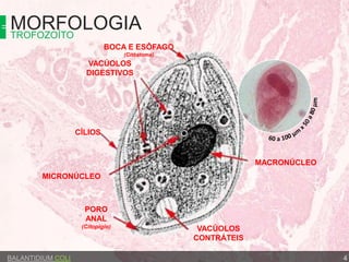 MORFOLOGIATROFOZOÍTO
BALANTIDIUM COLI 4
MICRONÚCLEO
MACRONÚCLEO
VACÚOLOS
CONTRÁTEIS
CÍLIOS
VACÚOLOS
DIGESTIVOS
BOCA E ESÔFAGO
(Citóstoma)
PORO
ANAL
(Citopigio)
 