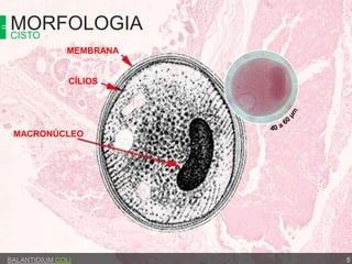 MORFOLOGIACISTO
BALANTIDIUM COLI
MACRONÚCLEO
CÍLIOS
MEMBRANA
5
 