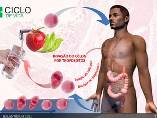 CICLODE VIDA
7BALANTIDIUM COLI
INVASÃO DO CÓLON
POR TROFOZOÍTOS
 