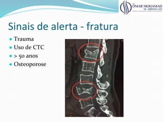 Sinais de alerta - fratura
● Trauma
● Uso de CTC
● > 50 anos
● Osteoporose
 
