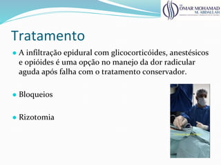 Tratamento
● A infiltração epidural com glicocorticóides, anestésicos
e opióides é uma opção no manejo da dor radicular
aguda após falha com o tratamento conservador.
● Bloqueios
● Rizotomia
 