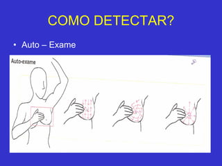 COMO DETECTAR? ,[object Object]