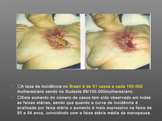  A taxa de incidência no Brasil é de 51 casos a cada 100.000
mulheres/ano sendo no Sudeste 68/100.000mulheres/ano.
 Este aumento do número de casos tem sido observado em todas
as faixas etárias, sendo que quando a curva de incidência é
analisada por faixa etária o aumento é mais expressivo na faixa de
50 a 54 anos, coincidindo com a faixa etária média da menopausa.
 