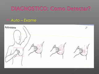    Auto – Exame
 