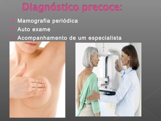    Mamografia periódica
   Auto exame
   Acompanhamento de um especialista
 