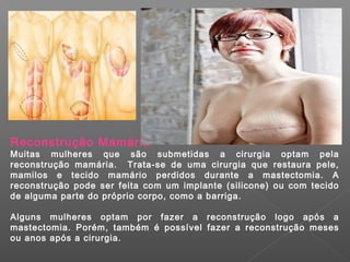 Reconstrução Mamária
Muitas mulheres que são submetidas a cirurgia optam pela
reconstrução mamária. Trata-se de uma cirurgia que restaura pele,
mamilos e tecido mamário perdidos durante a mastectomia. A
reconstrução pode ser feita com um implante (silicone) ou com tecido
de alguma parte do próprio corpo, como a barriga.

Alguns mulheres optam por fazer a reconstrução logo após a
mastectomia. Porém, também é possível fazer a reconstrução meses
ou anos após a cirurgia.
 