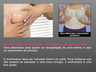 Enchimento de silicone – Cuidando da autoestima
Uma alternativa para ajudar na recuperação da auto-estima é usar
um enchimento de silicone.


O enchimento deve ser colocado dentro do sutiã. Para mulheres que
não querem se submeter a uma nova cirurgia, o enchimento é uma
boa opção.
 