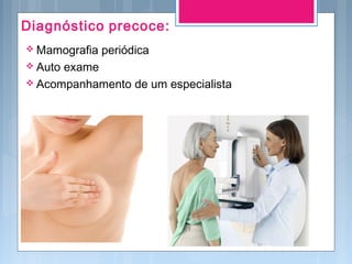 Diagnóstico precoce:
 Mamografia periódica
 Auto exame
 Acompanhamento de um especialista
 