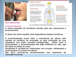 Os tratamentos:
A Hormonioterapia
A mama necessita de hormônios sexuais para seu crescimento e
funcionamento.
O câncer de mama mantém certa dependência desses hormônios.
A hormonioterapia busca inibir o crescimento do câncer pela
retirada do hormônio da circulação ou pela introdução de uma
substância com efeito contrário (antagonista). Assim como a
quimioterapia, a hormonioterapia tem ação sistêmica ou seja, age
em todas as partes do corpo.
Geralmente é utilizada em combinação com cirurgia, radioterapia e
quimioterapia no controle do câncer.
Não deve confundir-se hormonioterapia com tratamento de
reposição hormonal.
 