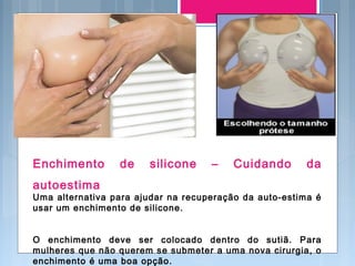 Enchimento de silicone – Cuidando da
autoestima
Uma alternativa para ajudar na recuperação da auto-estima é
usar um enchimento de silicone.
O enchimento deve ser colocado dentro do sutiã. Para
mulheres que não querem se submeter a uma nova cirurgia, o
enchimento é uma boa opção.
 