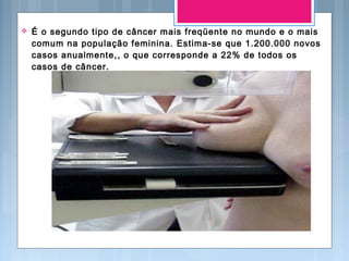  É o segundo tipo de câncer mais freqüente no mundo e o mais
comum na população feminina. Estima-se que 1.200.000 novos
casos anualmente,, o que corresponde a 22% de todos os
casos de câncer.
 