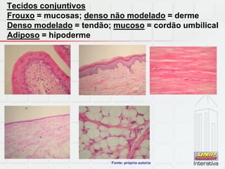Tecidos conjuntivos
Frouxo = mucosas; denso não modelado = derme
Denso modelado = tendão; mucoso = cordão umbilical
Adiposo = hipoderme
Fonte: própria autoria
 
