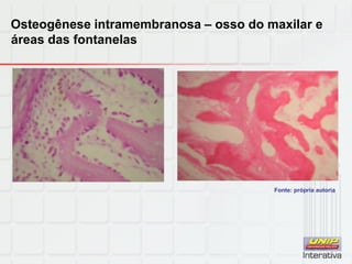 Osteogênese intramembranosa – osso do maxilar e
áreas das fontanelas
Fonte: própria autoria
 