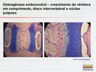 Osteogênese endocondral – crescimento da vértebra
em comprimento, disco intervertebral e núcleo
pulposo
Fonte: própria autoria
 