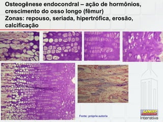 Osteogênese endocondral – ação de hormônios,
crescimento do osso longo (fêmur)
Zonas: repouso, seriada, hipertrófica, erosão,
calcificação
Fonte: própria autoria
 