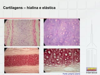 Cartilagens – hialina e elástica
Fonte: própria autoria
 