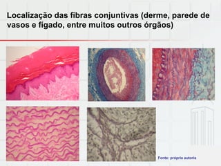 Localização das fibras conjuntivas (derme, parede de
vasos e fígado, entre muitos outros órgãos)
Fonte: própria autoria
 