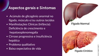 Aspectos gerais e Sintomas
Acúmulo de glicogênio anormal no
fígado, músculo e/ou outros tecidos
Manifestações Clínicas (Infância):
Deficiência de crescimento e
hepatoesplenomegalia
Cirrose progressiva e insuficiência
hepática
Problema qualitativo
Baixa expectativa de vida
Font
e:
Goo
gle
Imag
ens
 