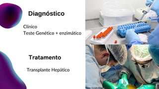 Tratamento
Transplante Hepático
Diagnóstico
Clínico
Teste Genético + enzimático
Fonte: Google Imagens
 