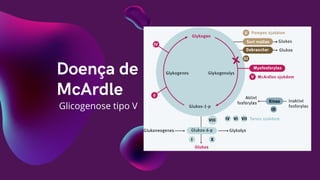 Doença de
McArdle
Glicogenose tipo V
 