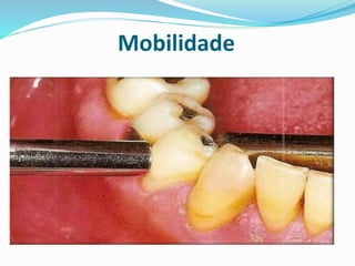 Mobilidade
 