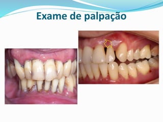 Exame de palpação
 