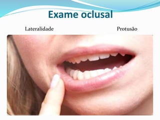 Exame oclusal
Lateralidade Protusão
 