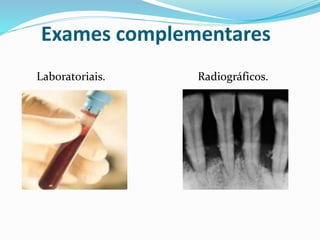 Exames complementares
Laboratoriais. Radiográficos.
 