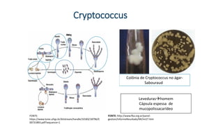 Cryptococcus
FONTE: http://www.fba.org.ar/panel-
gestion/InformeResultado/MI/mi27.htm
Colônia de Cryptococcus no ágar-
Sabouraudg
FONTE:
https://www.lume.ufrgs.br/bitstream/handle/10183/18796/0
00731893.pdf?sequence=1
Levedurashomem
Cápsula espessa de
mucopolissacarídeo
 