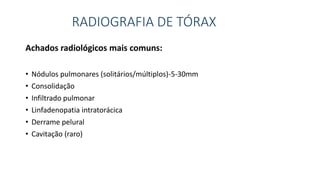 RADIOGRAFIA DE TÓRAX
Achados radiológicos mais comuns:
• Nódulos pulmonares (solitários/múltiplos)-5-30mm
• Consolidação
• Infiltrado pulmonar
• Linfadenopatia intratorácica
• Derrame pelural
• Cavitação (raro)
 