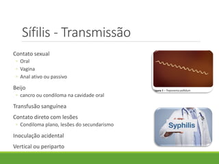 Sífilis - Transmissão
Contato sexual
◦ Oral
◦ Vagina
◦ Anal ativo ou passivo
Beijo
◦ cancro ou condiloma na cavidade oral
Transfusão sanguínea
Contato direto com lesões
◦ Condiloma plano, lesões do secundarismo
Inoculação acidental
Vertical ou periparto
 