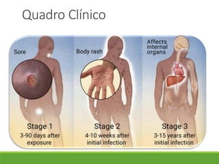Quadro Clínico
 