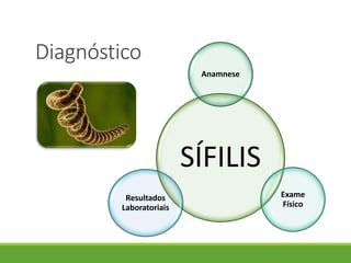 Diagnóstico
SÍFILIS
Anamnese
Exame
Físico
Resultados
Laboratoriais
 