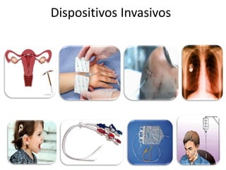 Dispositivos Invasivos
 